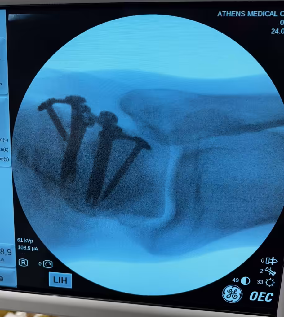 Case Image