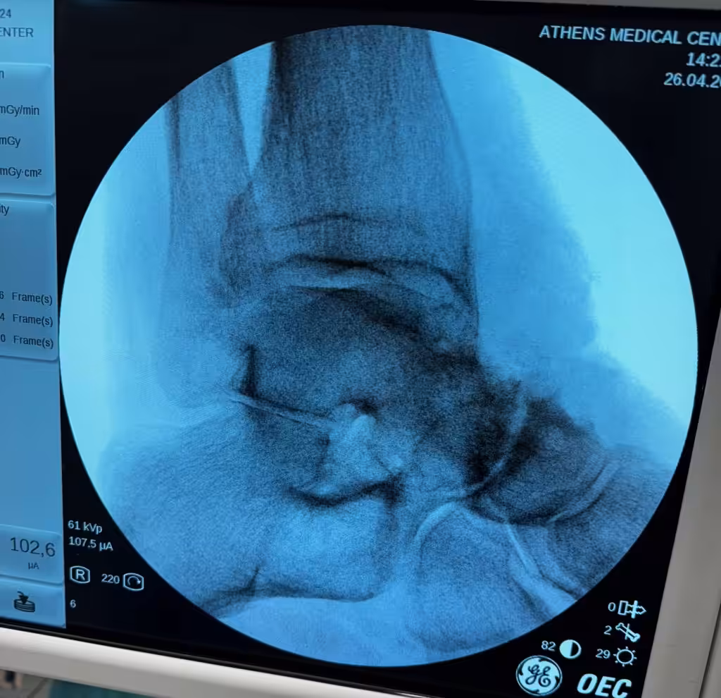 Case Image