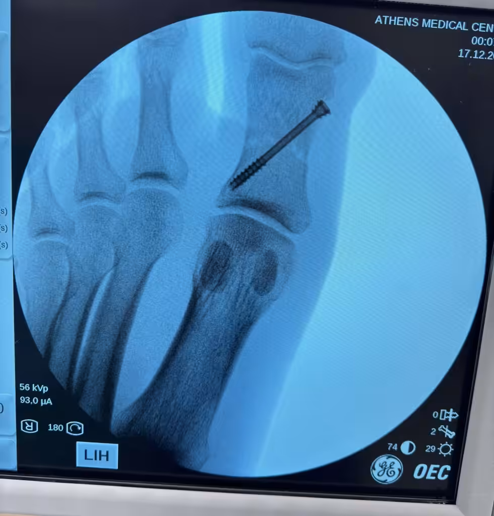 Case Image