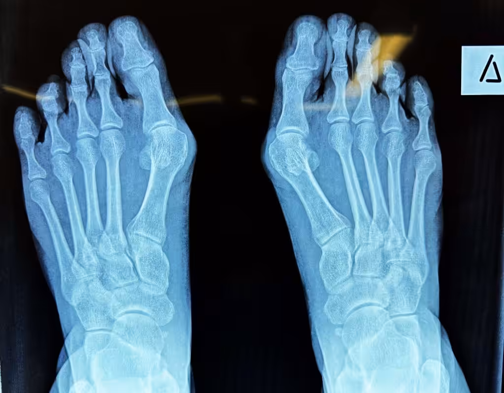 Case Image
