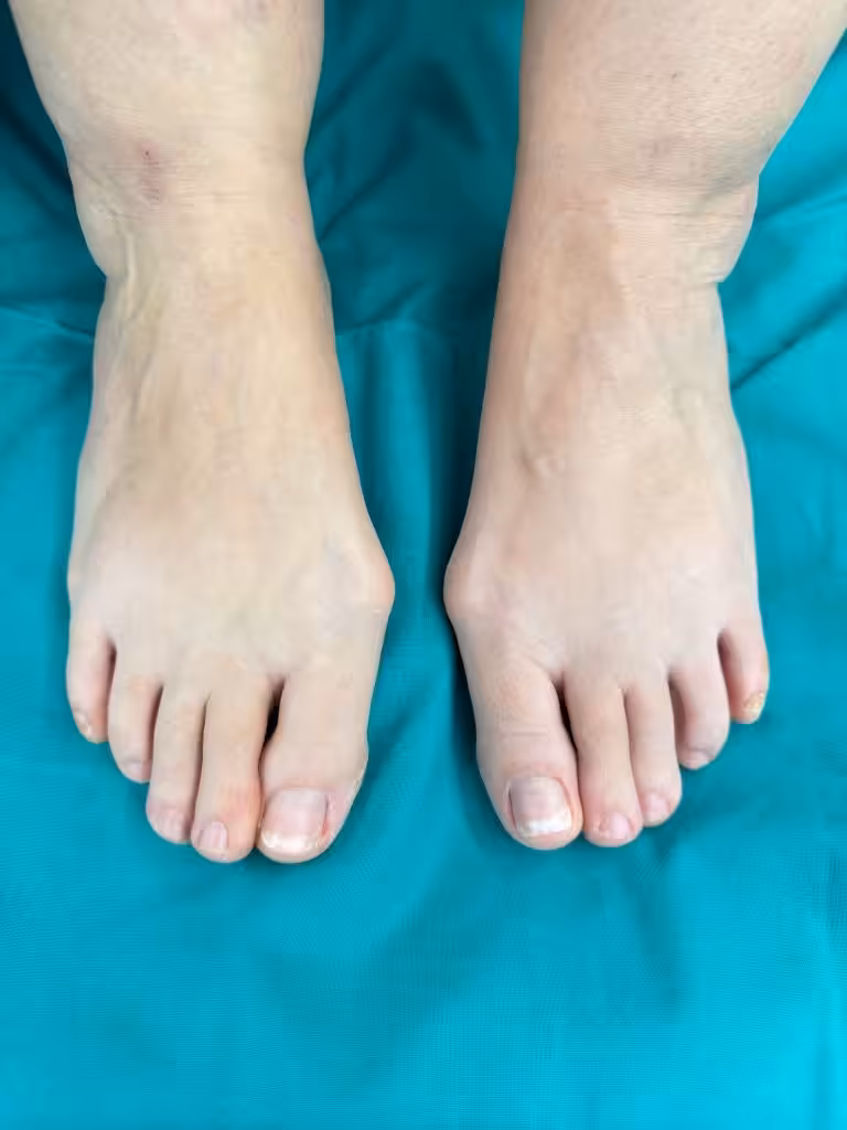 Case Image