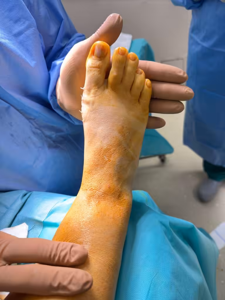 Case Image