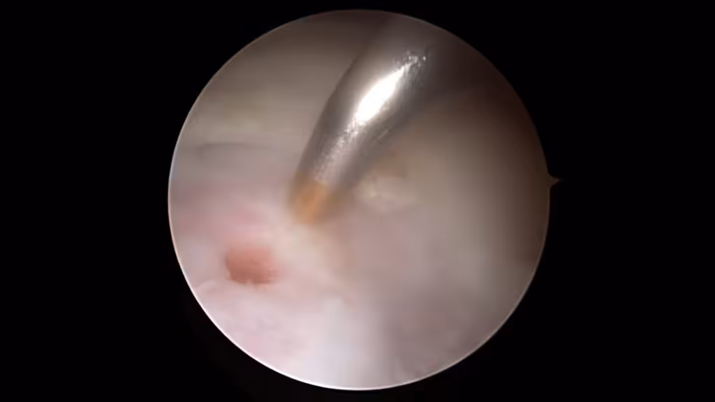 Case Image