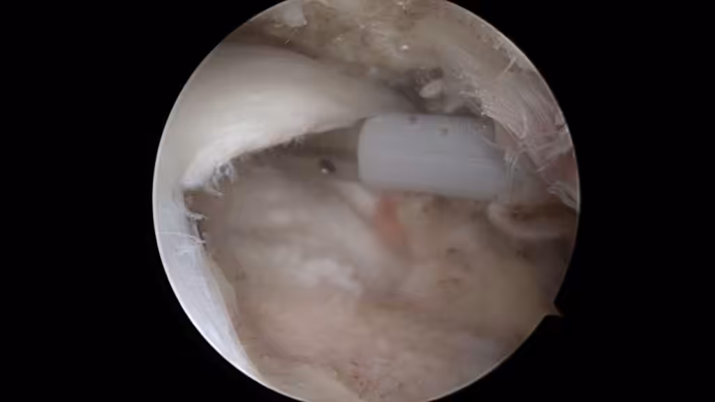 Case Image