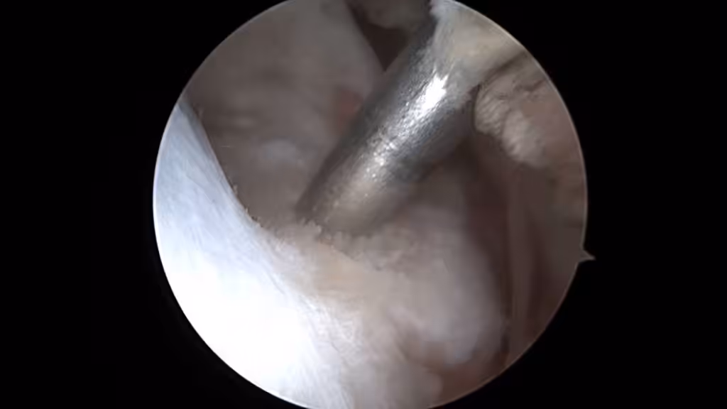 Case Image