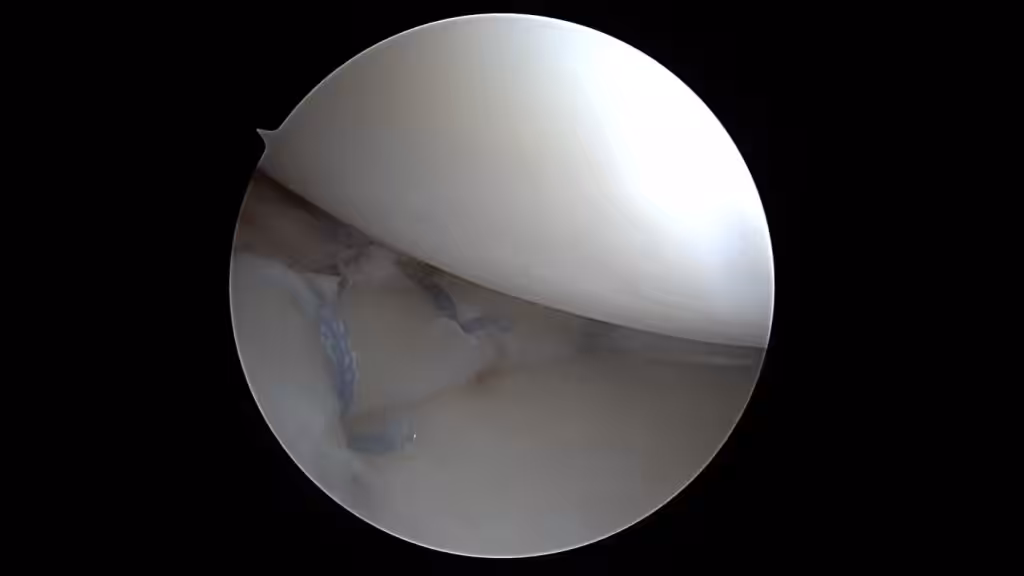 Case Image
