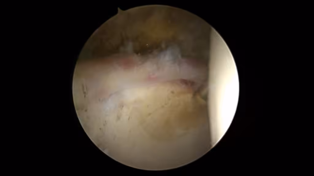 Case Image
