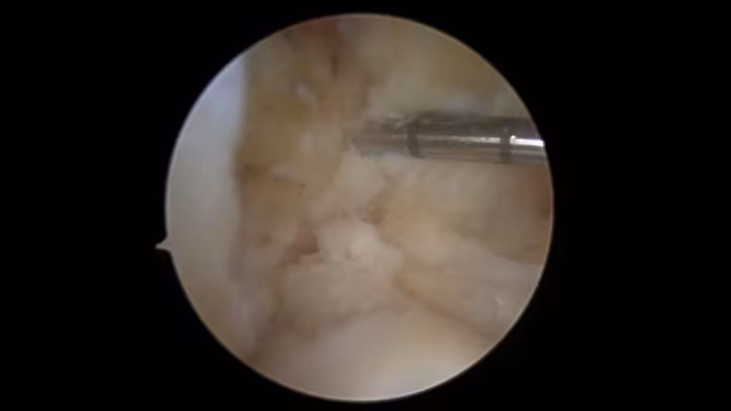 Case Image
