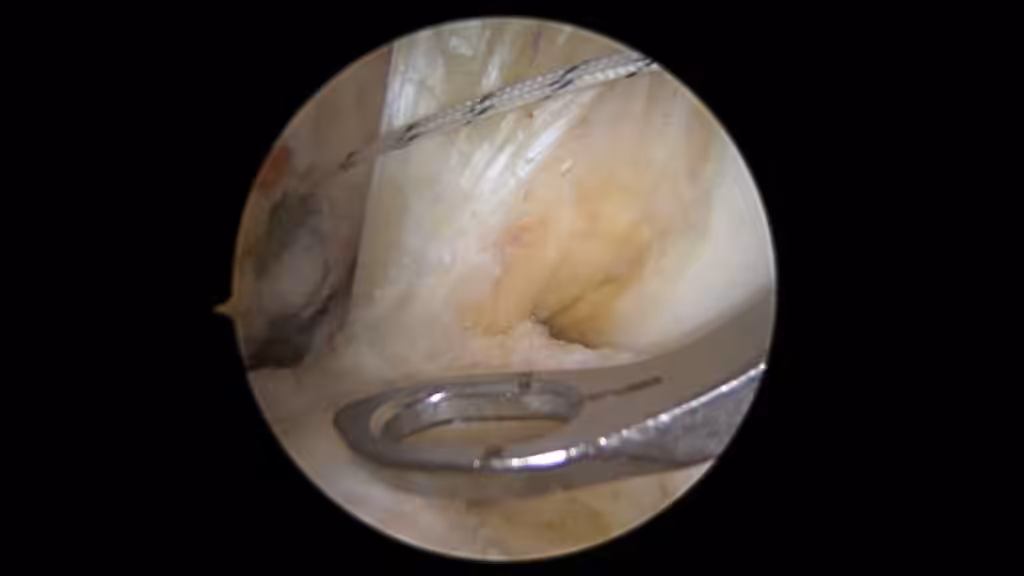 Case Image