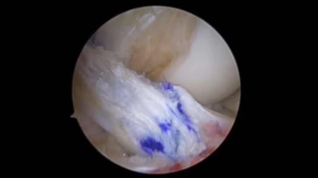 Case Image