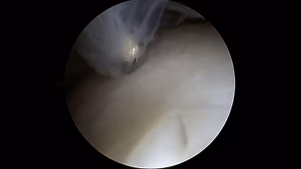 Case Image