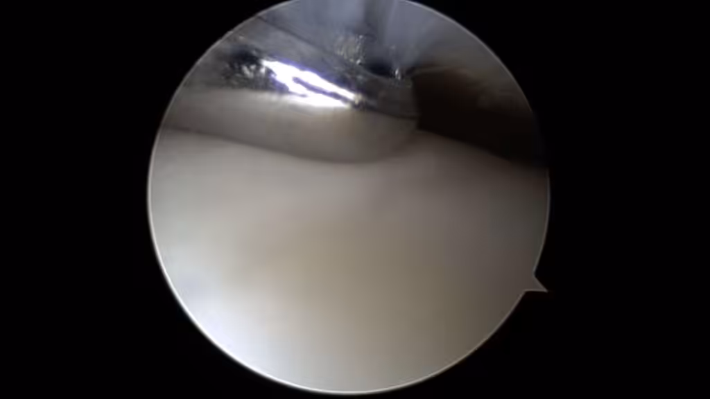 Case Image