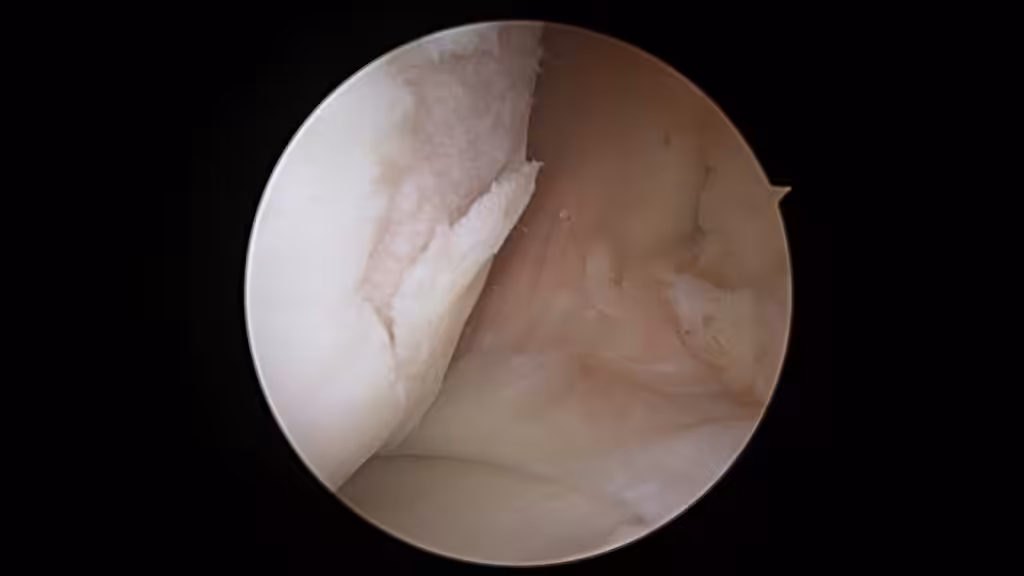 Case Image
