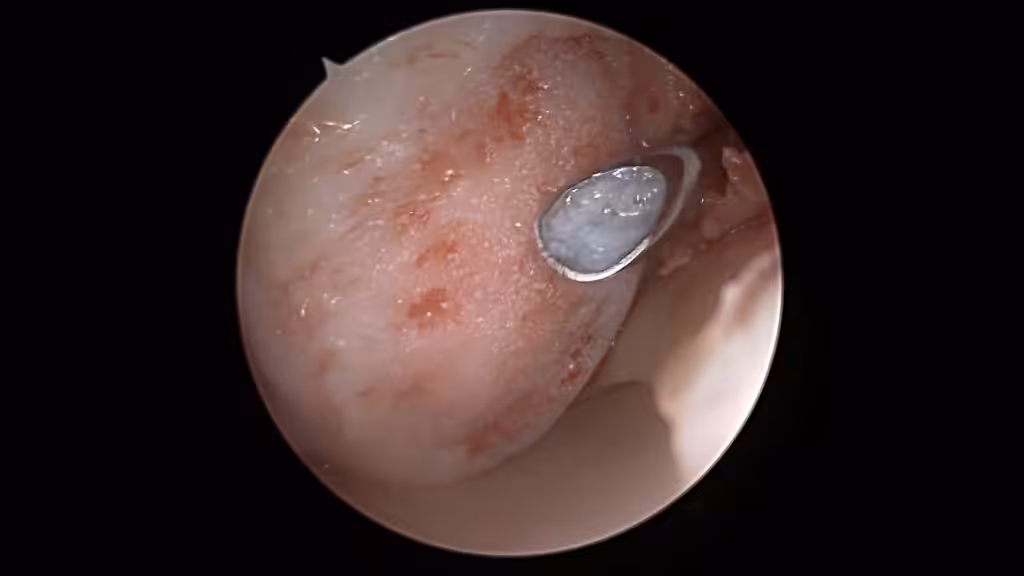 Case Image