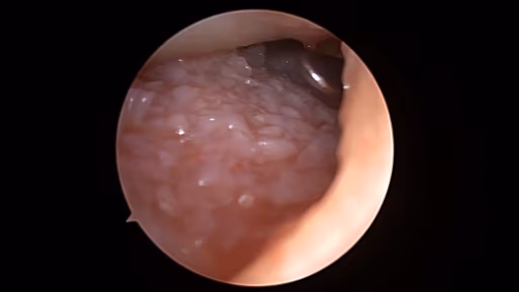 Case Image