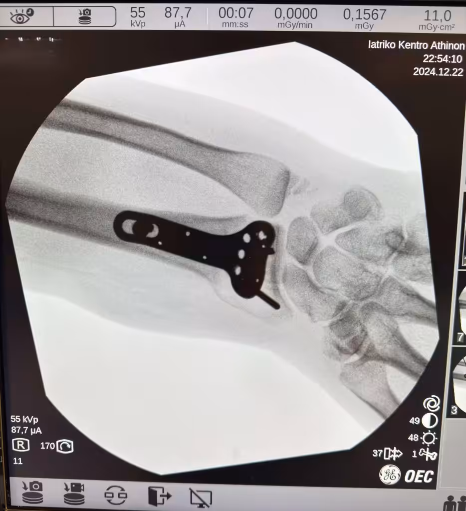 Case Image