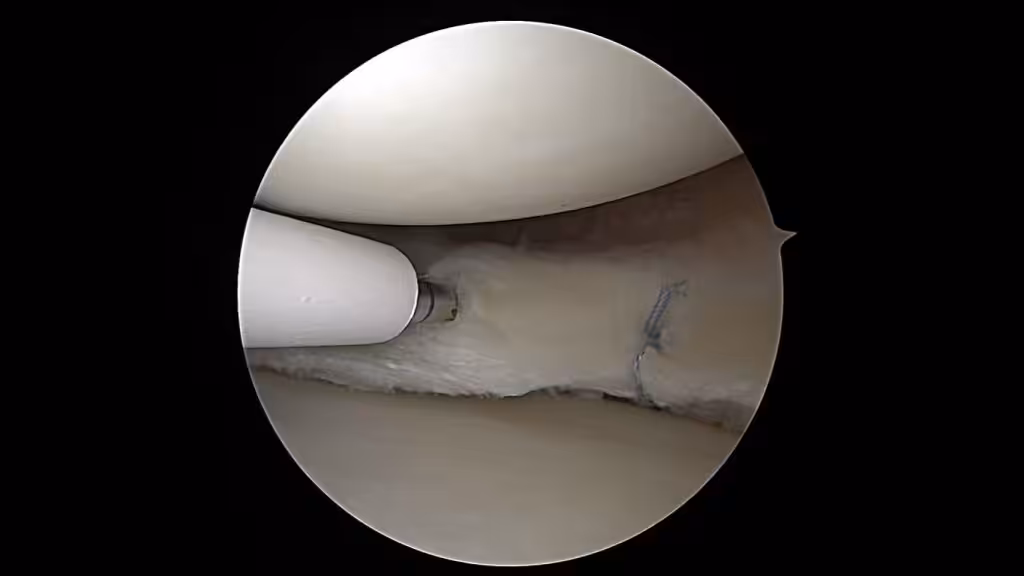 Case Image