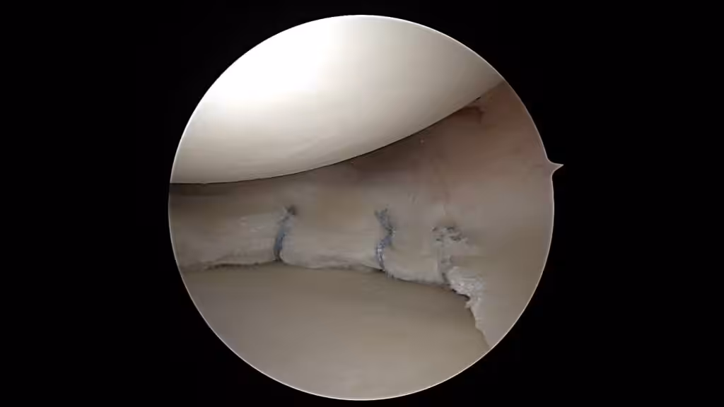 Case Image