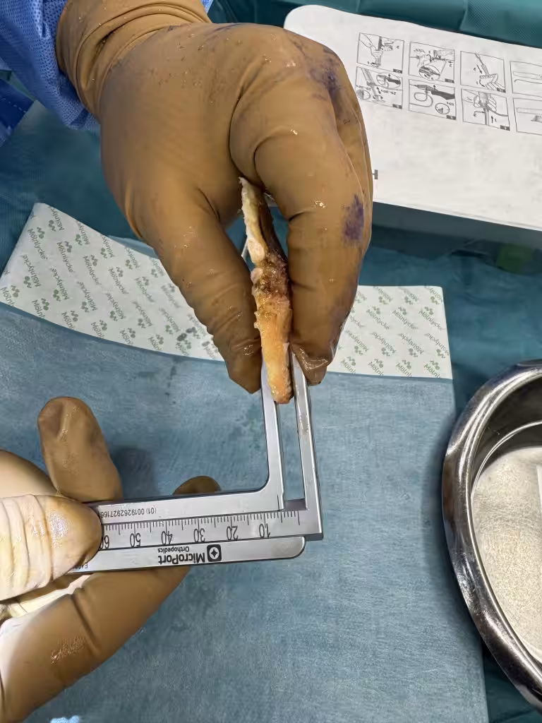 Case Image