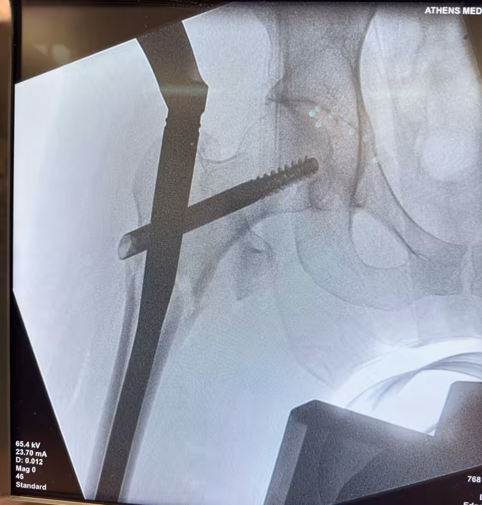 Case Image