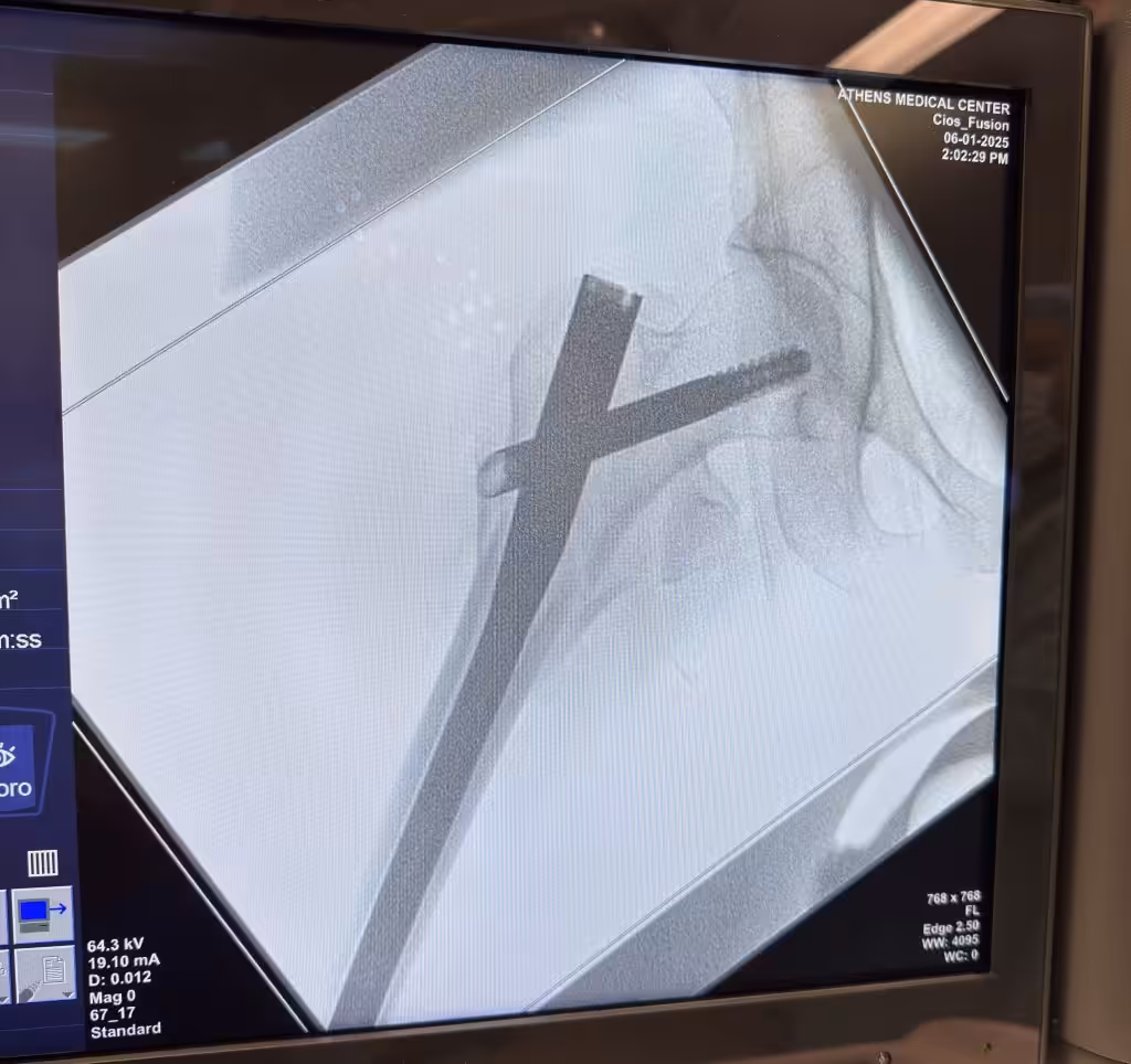 Case Image