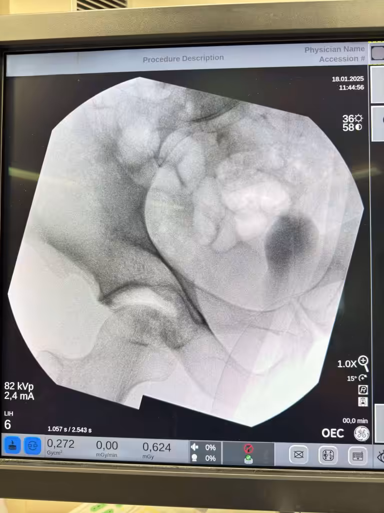 Case Image