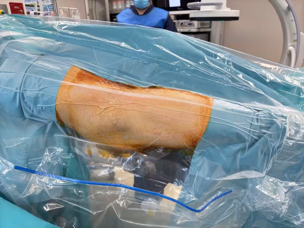 Case Image