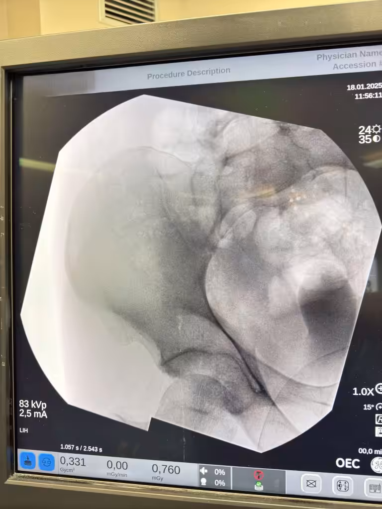 Case Image
