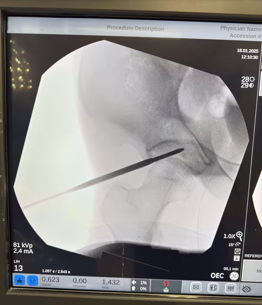 Case Image