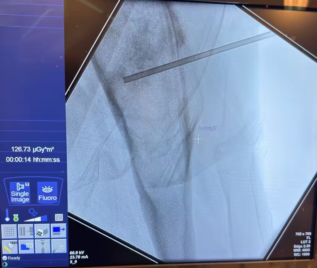 Case Image