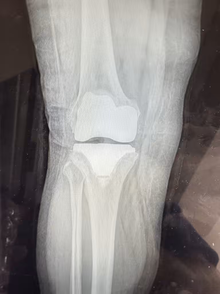Case Image