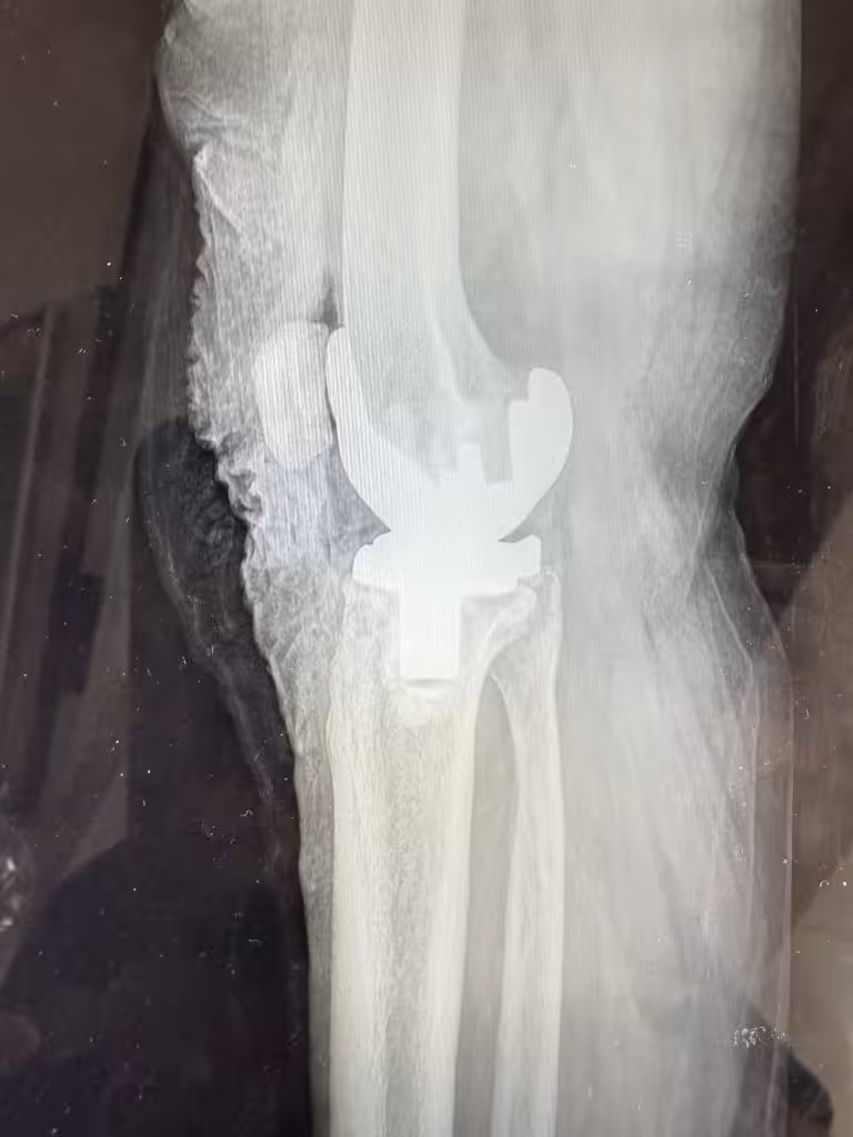 Case Image