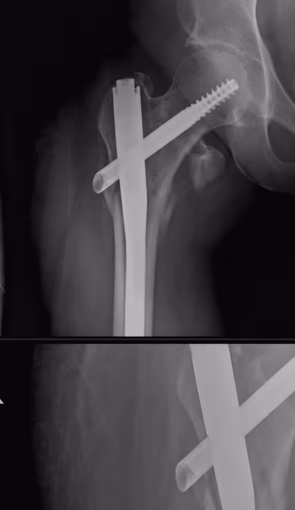 Case Image