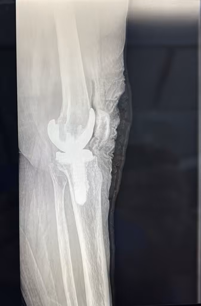 Case Image