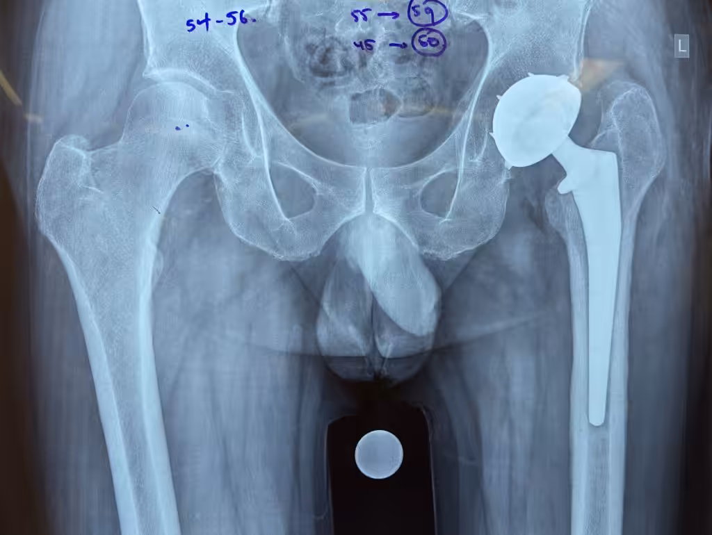 Case Image