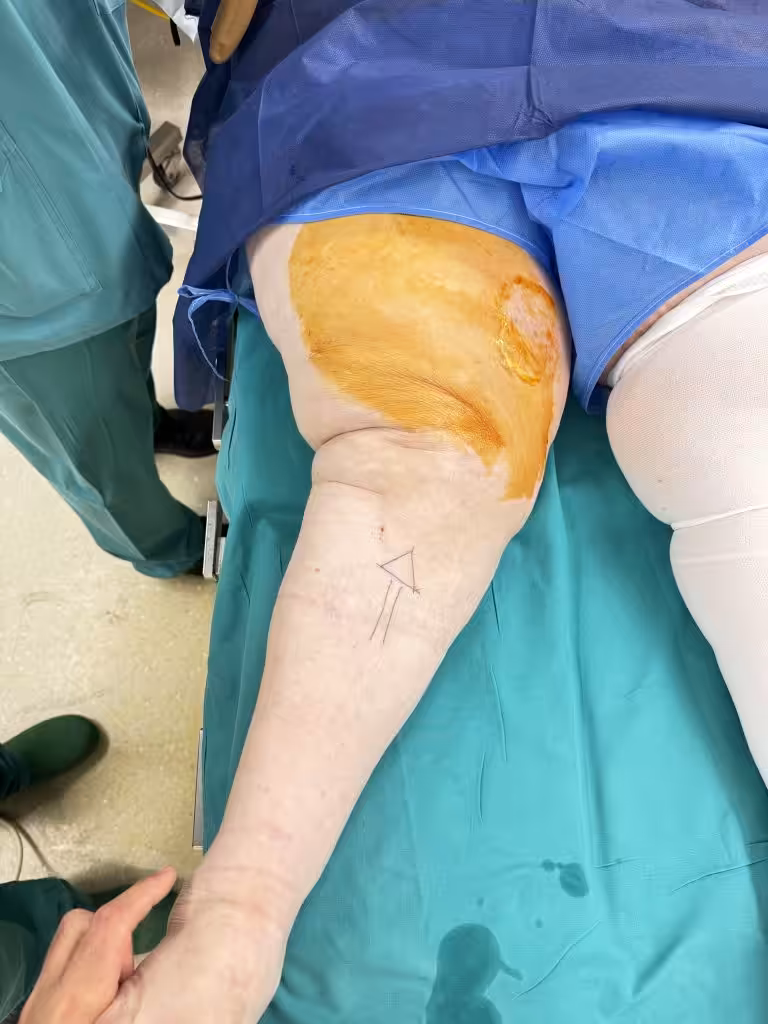Case Image