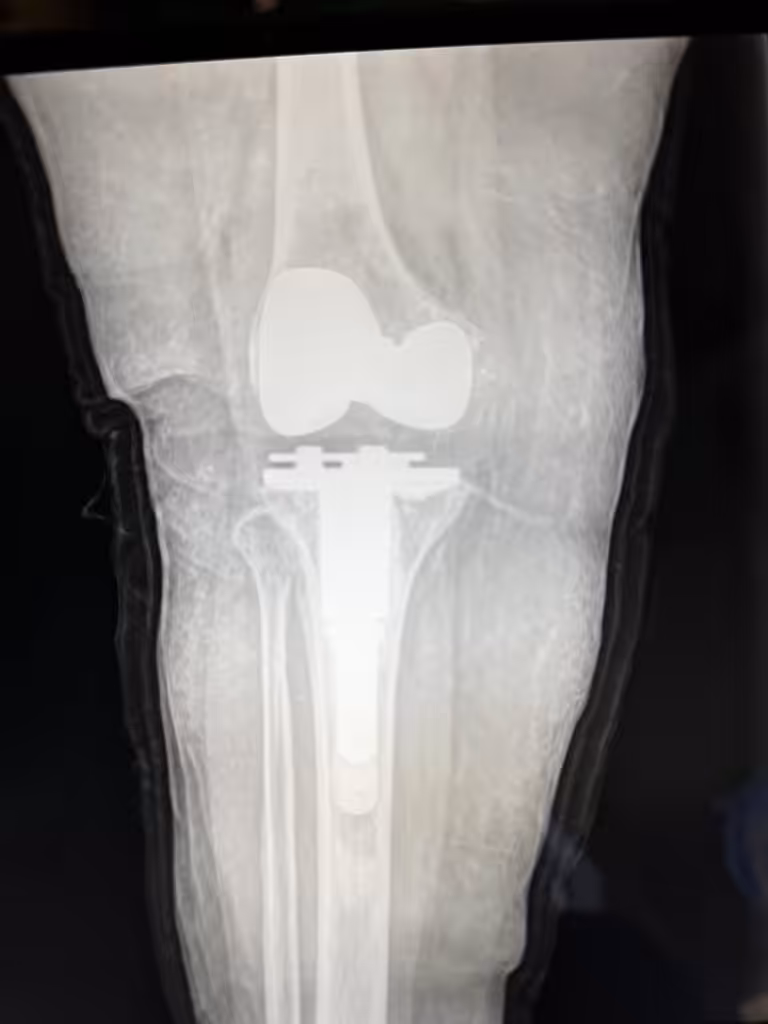 Case Image