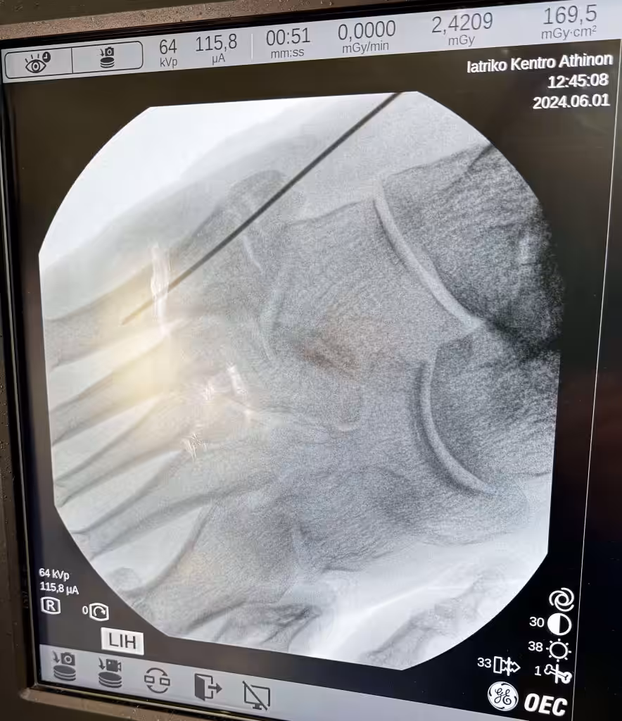 Case Image