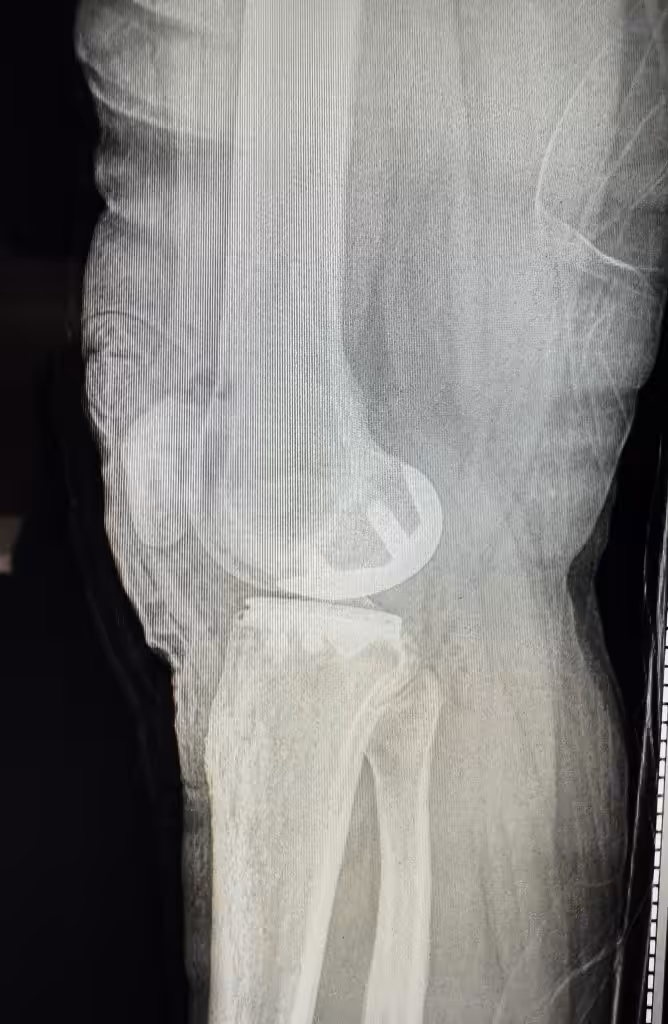 Case Image
