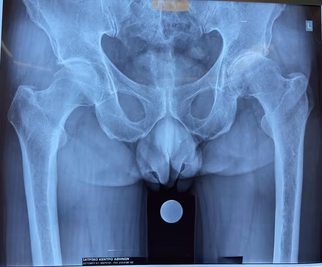 Case Image