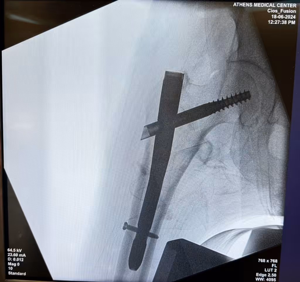Case Image