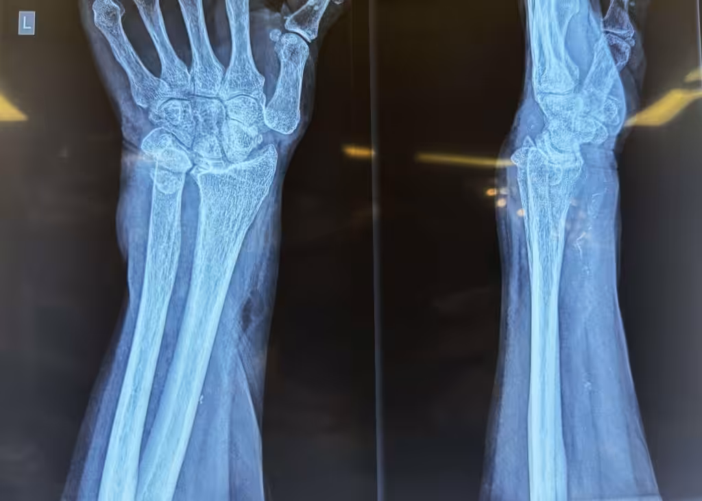 Case Image