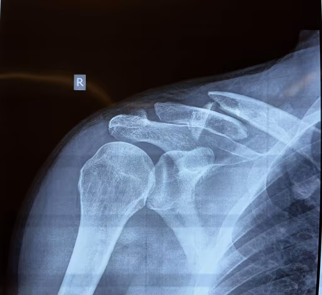 Case Image
