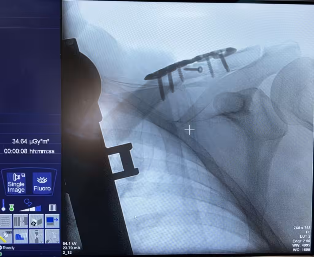 Case Image