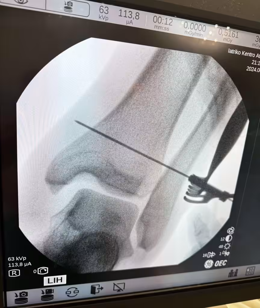 Case Image