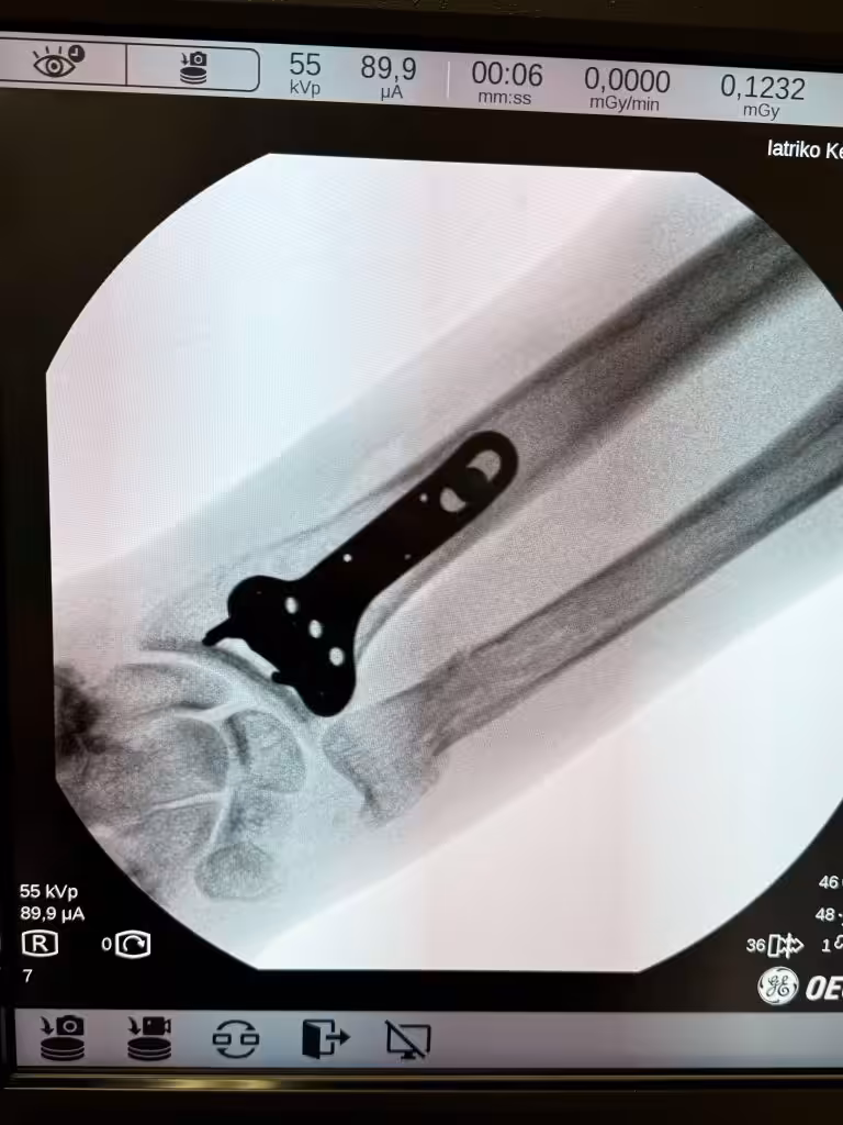 Case Image