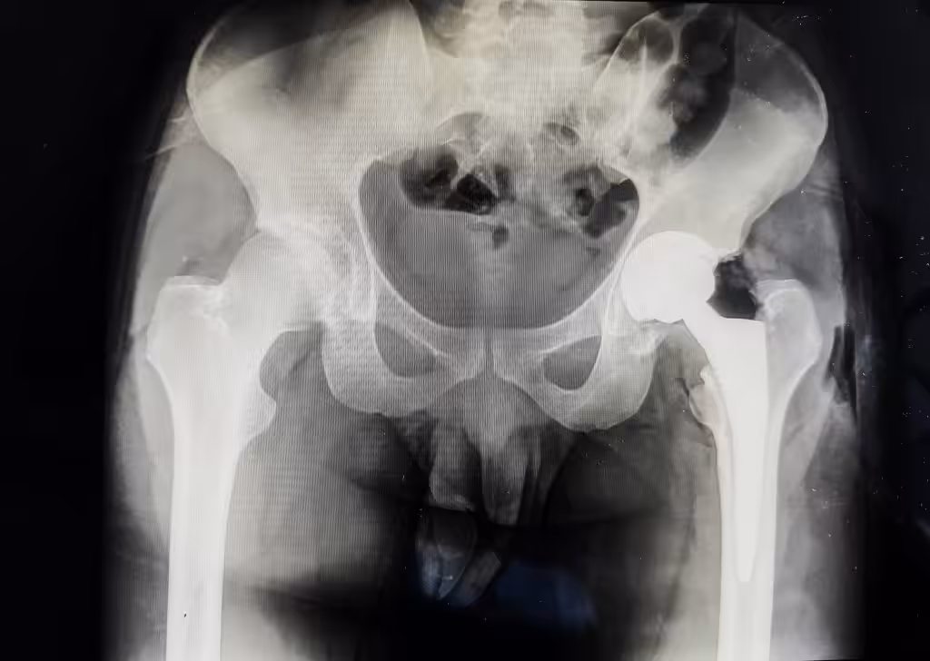 Case Image