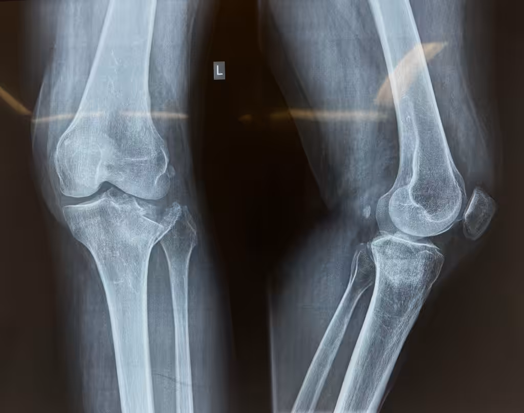 Case Image