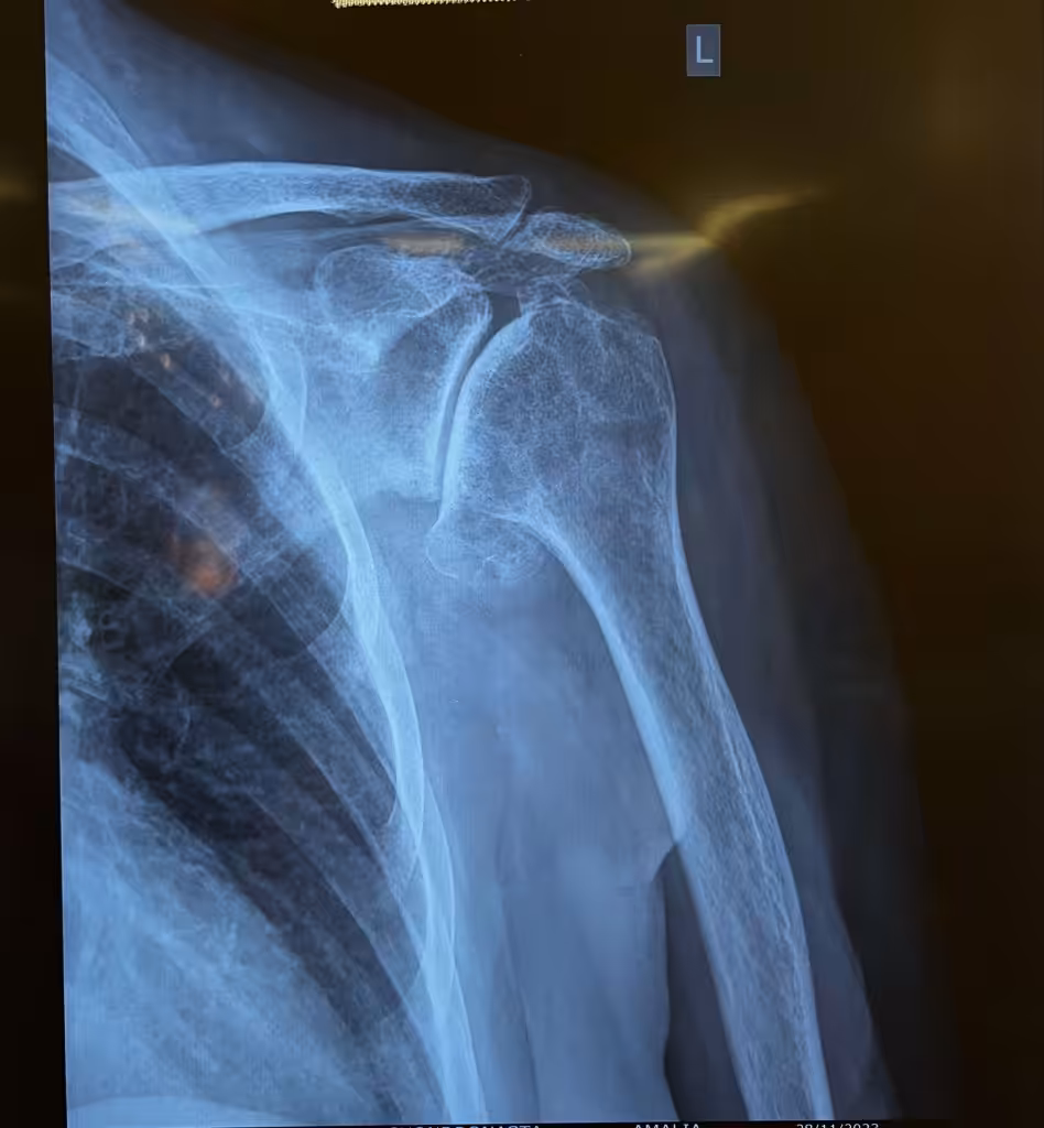 Case Image