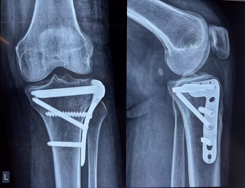 Case Image